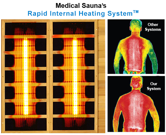 Medical Saunas 3' comparison: Rapid internal heat system.
